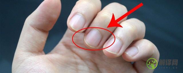 手指甲上的月牙越来越少怎么回事，手指甲上的月牙越来越少的原因？
