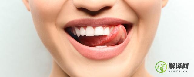 怎样防止蛀牙(预防蛀牙)